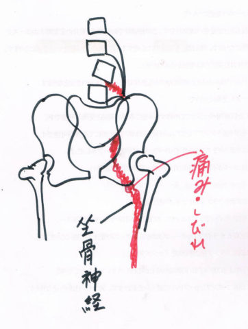 が 痛い 病院 腰 脊椎（腰・背中・首）が痛い方へ｜札幌市中央区のいとう整形外科病院